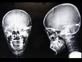 X-Ray Oddities arrow in head