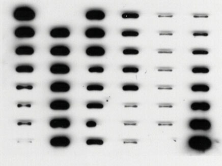 Figure 5 illustrates the quantification of DNA by hybridization 
              to human DNA-specific probes.