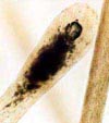 Graphic showing a hair root