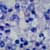 closeup photo of a tuberculosis cells